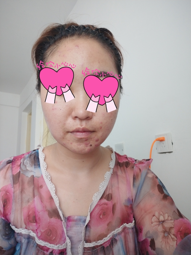 花酿玫瑰双色气垫BB霜怎么样,是什么牌子,第9张 花酿玫瑰双色气垫BB霜怎么样,是什么牌子,第9张
