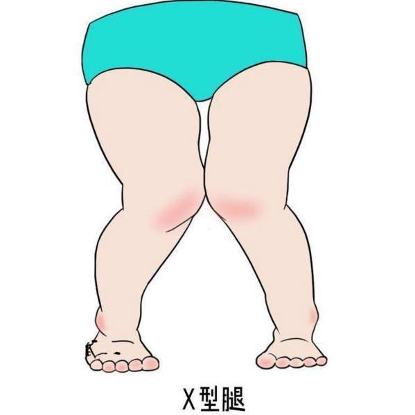 女生长期穿紧身裤,这两个部位明显不一样
