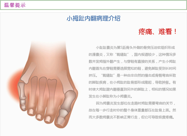 穿鞋使用儿童硅胶小脚趾拇外翻分趾器日用小脚趾变形内翻脚趾重叠