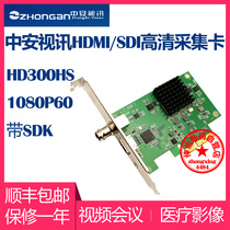 Zhongan Video HD300HS HD Capture Card HDMI SDI video conference 1080p Images 2 channels simultaneously