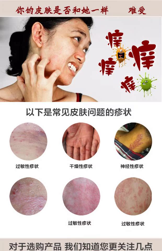 杏璞霜成人顽固修复护肤清湿霜止痒清爽红疹 活动说明