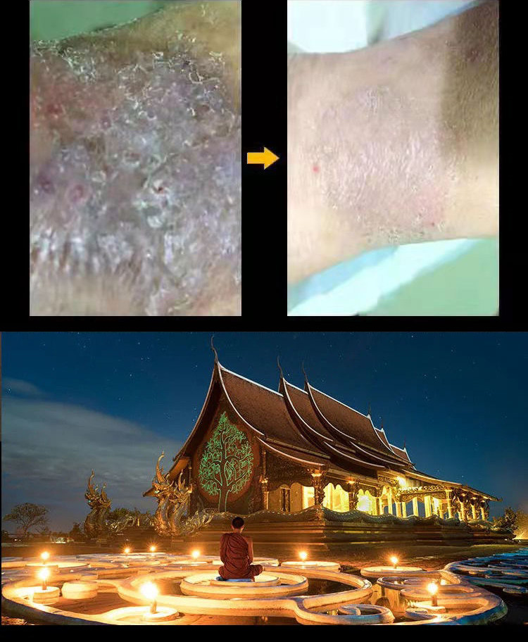 苗弟子蛇油膏皮肤干燥瘙痒全身外用湿疹药膏止痒去脸痒过敏抑菌