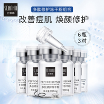 Lyophilized powder oligopeptide extract combination Repair lighten acne marks Brighten skin tone Shrink pores Essence Improve skin