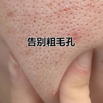 (Small Red Book Hot Sell) Small bubble oligopeptides mask moisturizing water tonic shrinkage pores also you tender white skin