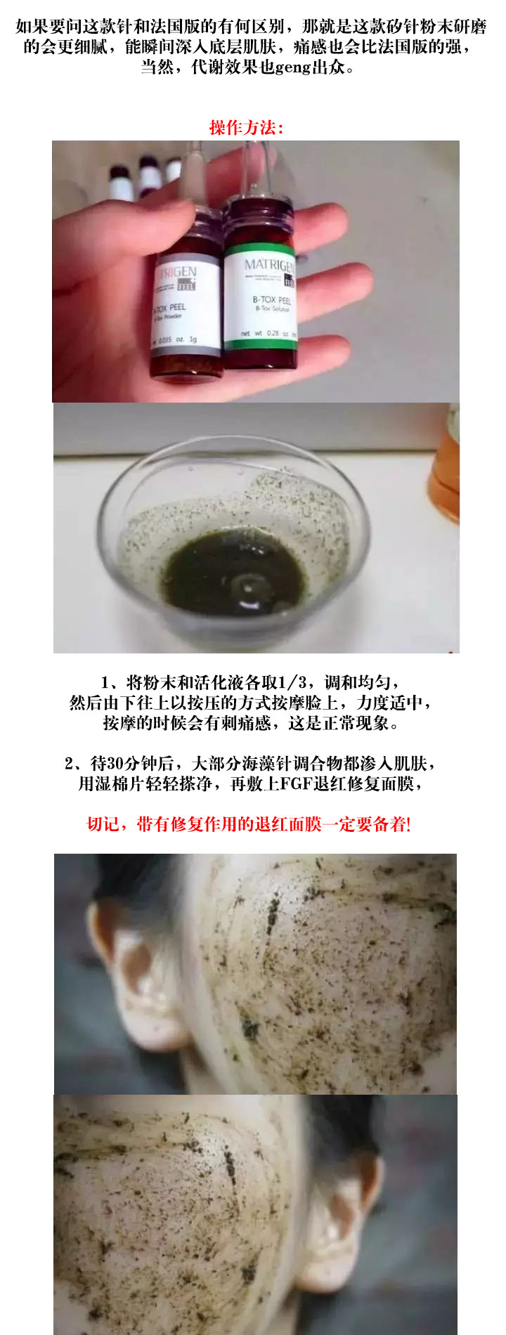 韩国b-tox peel海藻矽针焕肤收缩毛孔祛痘坑紧致嫩肤净淡痘印