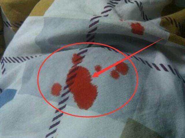 姨妈血侧漏到床单上,不用洗一招就解决!