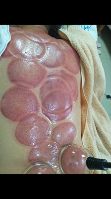 第七代效果很好。吸力特别大。客服特耐心。用于有氧拔罐一吸一放,比传统拔罐舒服。几个朋友试用后都说要跟着买一个自用。 第七代效果很好。吸力特别大。客服特耐心。用于有氧拔罐一吸一放,比传统拔罐舒服。几个朋友试用后都说要跟着买一个自用。