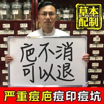 Anti-acne pit repair concave hole filling regeneration men's anti-acne scar desalination anti-acne cream artifact