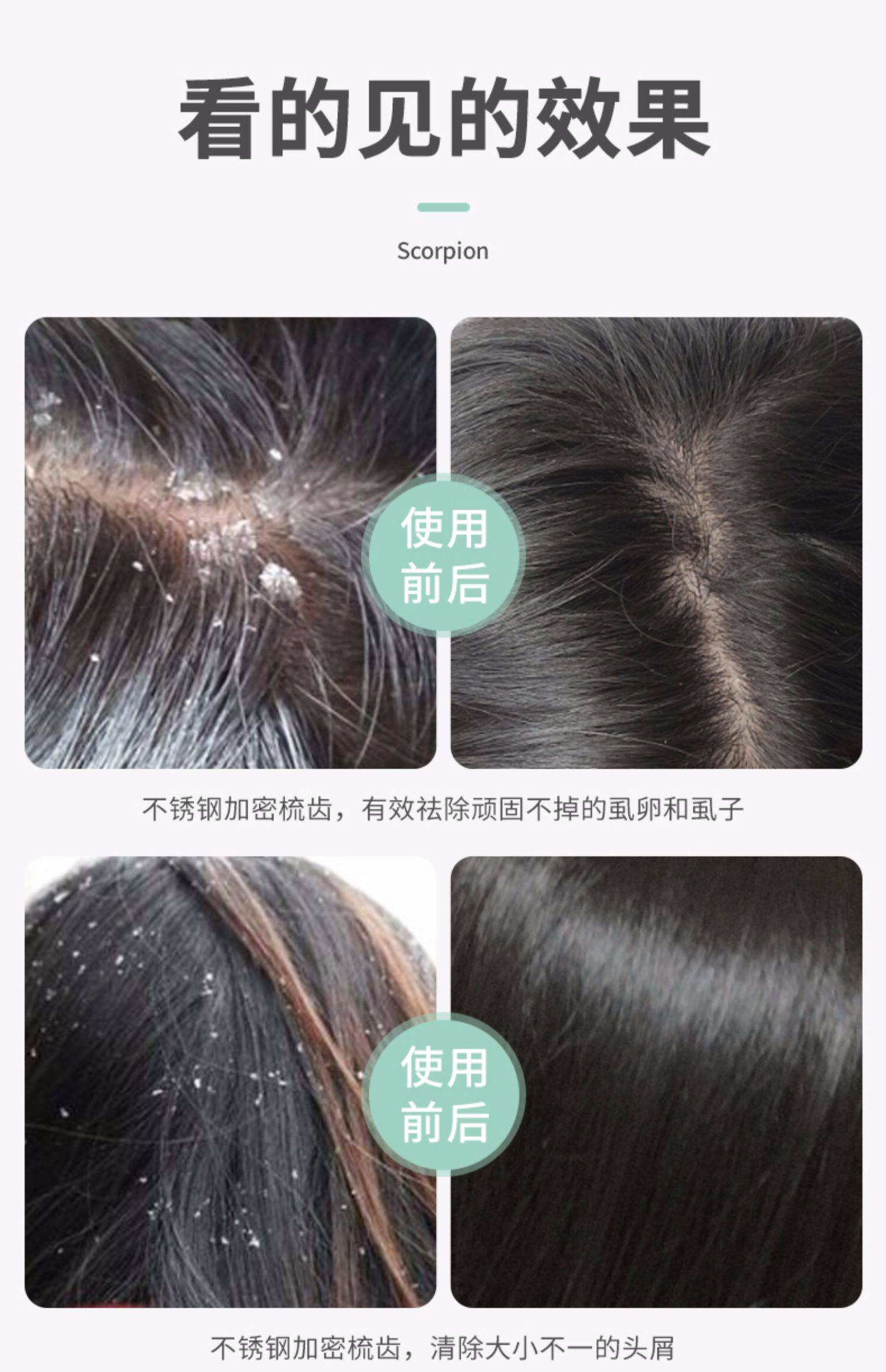 篦子除头虱梳子细齿密梳超密齿箅子梳刮头老式加密去头虱子儿童女_拿