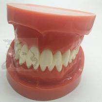 Dental material standard model tooth tray tooth grain gum restoration doctor-patient communication student practice tooth preparation explanation