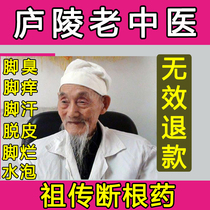 The beriberi root artifact itching peeling sterilization medicine spray treatment of rotten feet foot water itching foot Smelly Foot