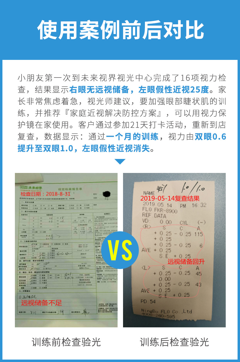 儿童眼部近弱视训练缓解疲劳按摩仪介绍
