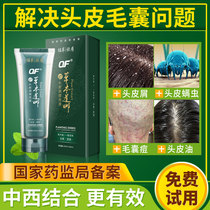 Herbal Lina Chinese herbal hair folliculitis shampoo dew mite dandruff anti-itching oil control Clean dandruff artifact