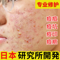 Japanese acne ointment to remove acne red and swollen cavity repair gel desalination acne back acne hole acne scar mens artifact