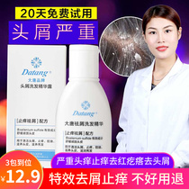 Datang brand dandruff shampoo severely remove dandruff from itching to remove antifungal portable