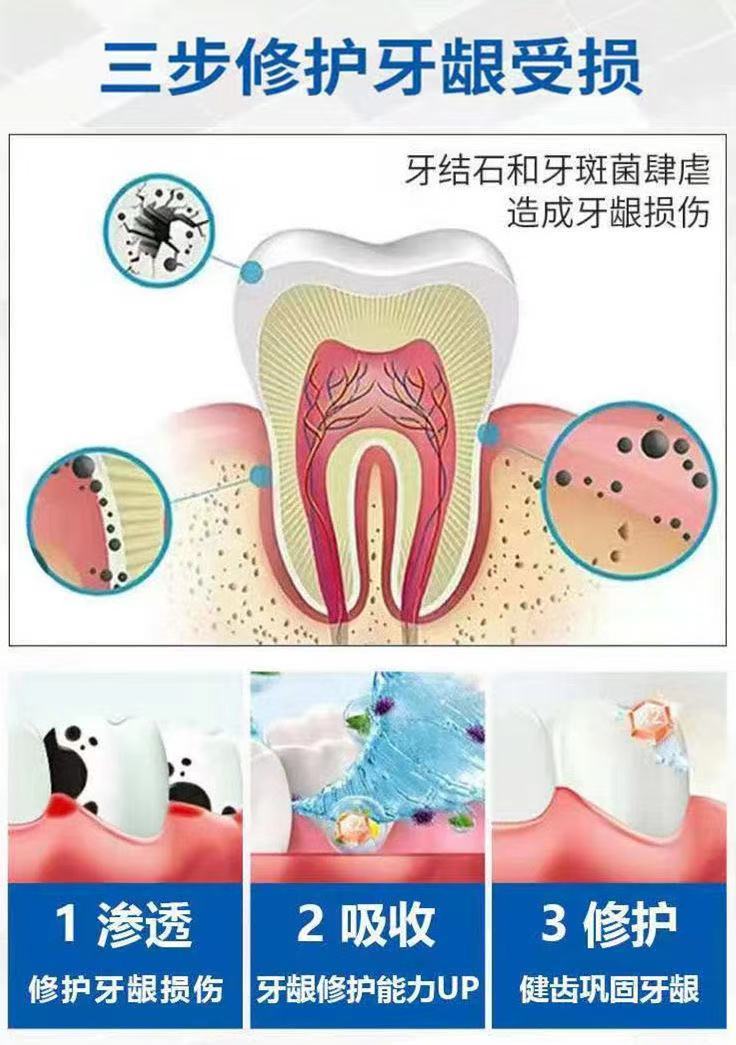 牙龈修护牙膏牙龈萎缩牙齿松动牙龈出血牙缝