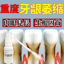 Treatment of periodontitis Gingival Gum Atrophy Repair Solid Tooth Regeneration Drug Denture Tooth Root Exposed Tooth Slit Leniency Special S