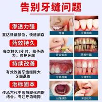 Dental Inflammation Tooth Loose Gingival Pain Bleeding Atrophy Slit Seminal Periodontal Teeth Leniency K50487 Charged Tooth Tooth