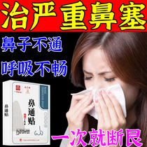 Nasal congestion ventilation stickers adult children cold runny nose baby allergic rhinitis special medicine nasal congestion nasal artifact