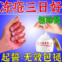Chilblain ointment antipruritic frostbite ointment childrens hands face ear frostbite antifreeze anticracking detumescence root special effect plaster