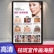 Beauty salon embroidered poster decorative poster comparison chart advertising acne spot removal super picosecond freckle poster hanging painting