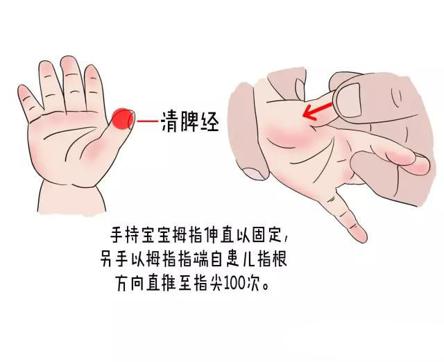快速正确处理小儿鹅口疮