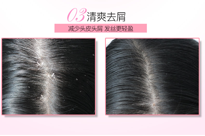 .清爽去屑减少头皮头屑发丝更轻盈-推好价 | 品质生活 精选好价