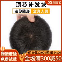 Hair sheet overhead Hair Tonic live-action Hair Loss invisible No Mark Flakes with Hair Loss and Hair Loss and Hair Loss and Hair Loss