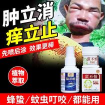 Bee sting with bee sting not afraid of bee jellyfish Jellyfish Bee Sting Drug Adoptive Beekeeper Special Acumination Pain Stop Itch A Spray