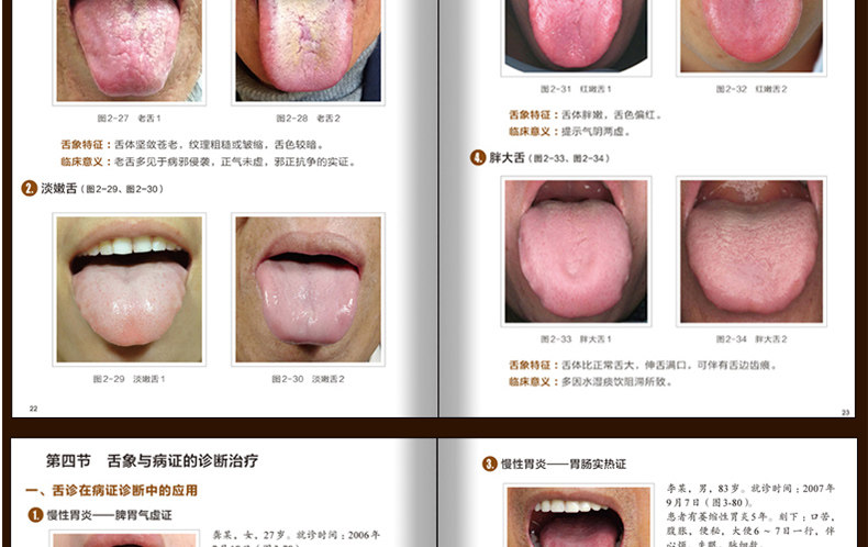 正版 中医舌诊临床图解 舌诊 许家佗 中医舌诊 舌诊断病 中医舌诊完全