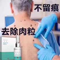 Go to monkey meat kernels Goose Eye Fluid Stick without pain Death to the skin Chicken Eyes Old Cocoon Thick cocoon Flesh Thorn sole toe