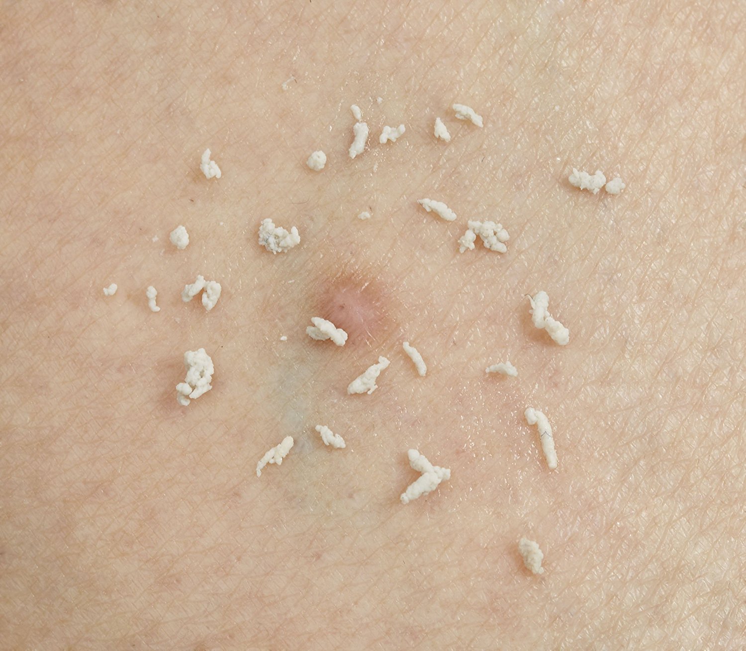 日本制代购女士专用去除淡化眼部颈部凸起脂肪粒角质粒油脂粒15g