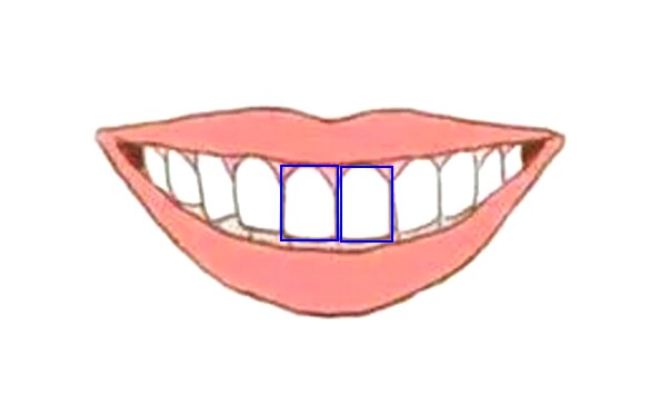 从门牙形状看出你的性格,一看一个准!