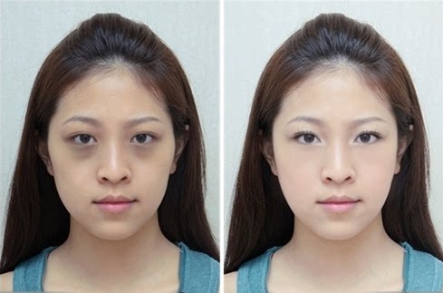 熬夜对皮肤的危害有多大?对比一下就知道