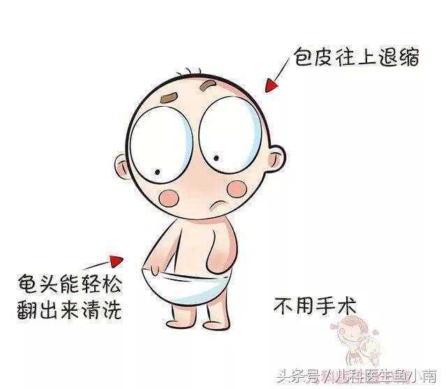 还有些宝宝的阴茎解剖结构异常,如尿道上裂及尿道下裂,隐匿性阴茎