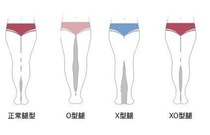 x型,o型腿型:过膝长靴