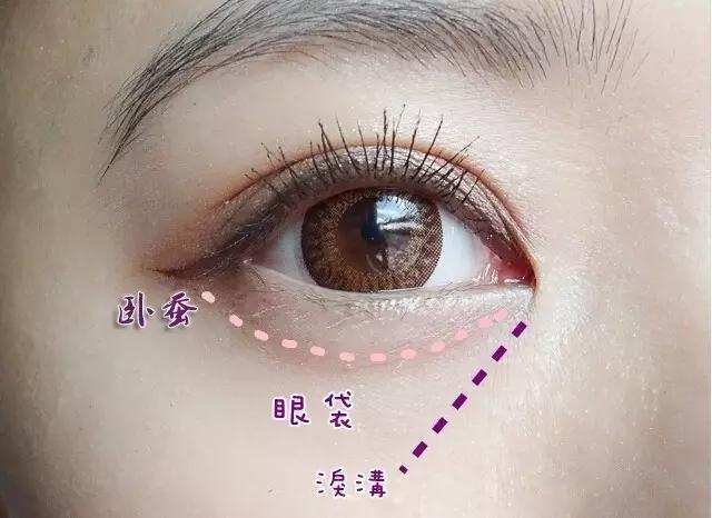 请直男们好好去百度一下卧蚕和眼袋的区别,不然真的要跪键盘了.