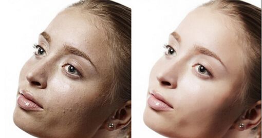 去角质原来有这么多讲究!