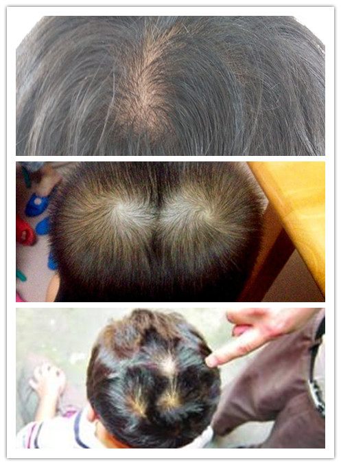 男生头顶上有两个旋涡的适合什么发型?