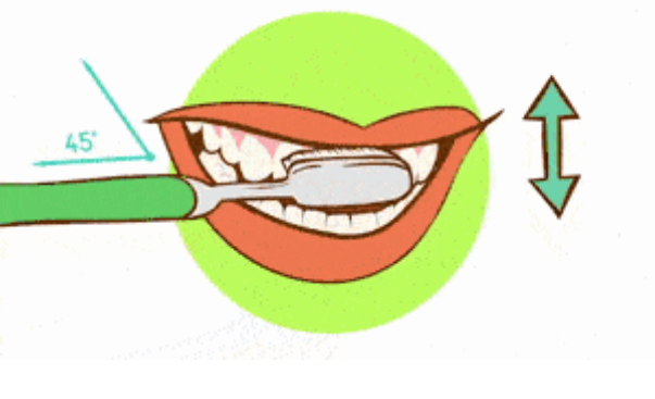 ①以45度角刷牙 将牙刷斜立呈45度角,用短,垂直或轻轻打圈的方式温柔