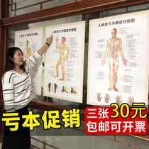 Body Meridians Acupoints Map High-definition Big Picture Acupoints and Disorders Control Wall Chart Full Body Standard Acupoint Maps Home Ys