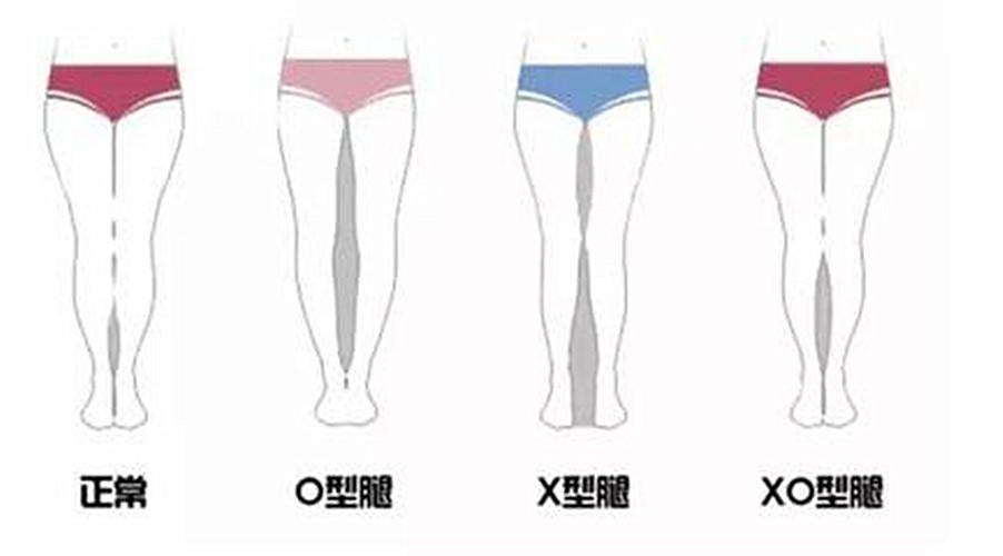 a,正常腿型 b,问题腿型(o型腿,x型腿,ox型腿)>>>(8) 【3】你的筒靠