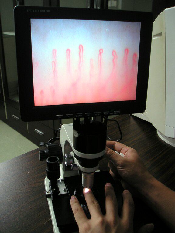 血流速能量检测仪微循环检测仪大量厂价直销