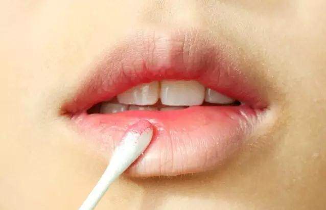 唇部周围黑色是什么?涂口红都不好看了