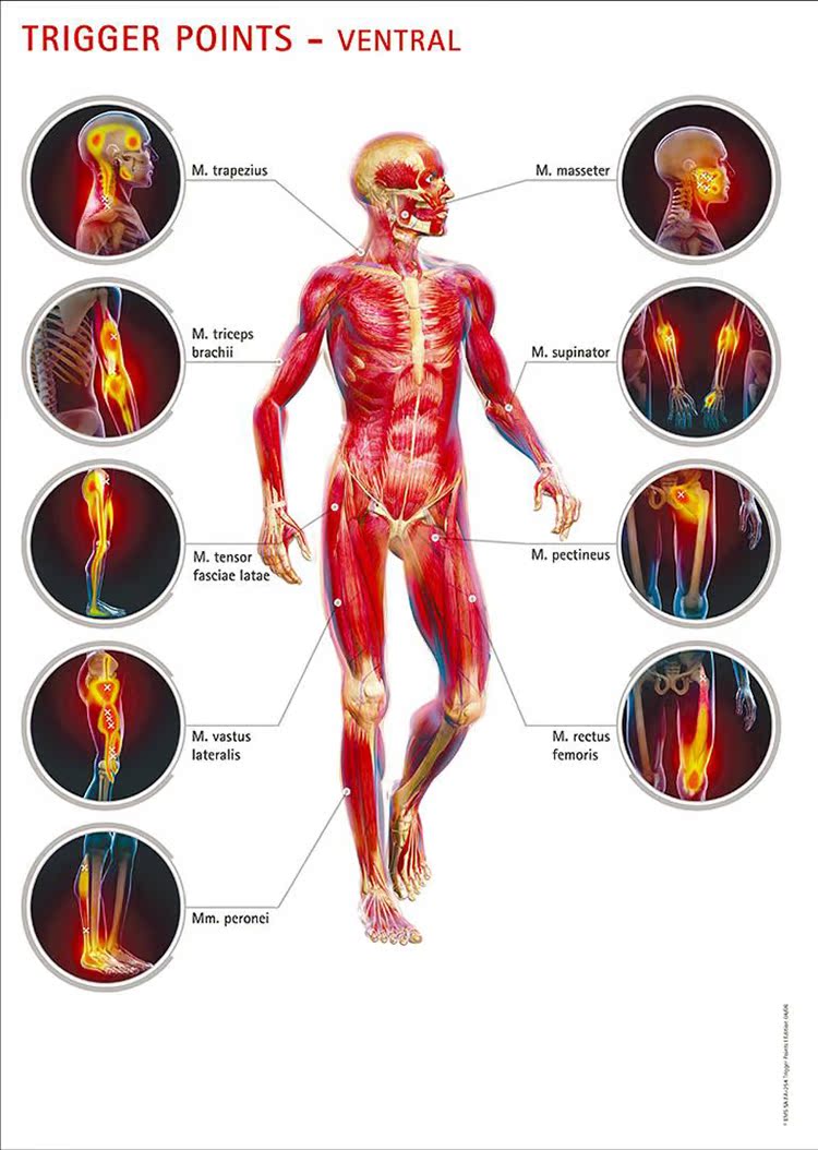肌肉激痛点速查手册图片
