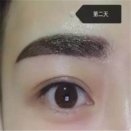 眉毛做完偏黑粗怎么办?脱痂后没色微红怎么办?