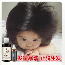Anti-shampoo men ginger King hair ginger anti-hair loss serious germinal additional dense hair off herbal hair renewal liquid