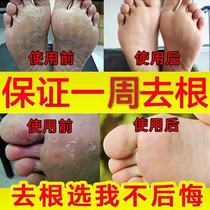 Go to blisters blisters blisters blisters blisters blisters blisters blisters blisters blisters blisters blisters blisters blisters blisters blisters blisters blisters