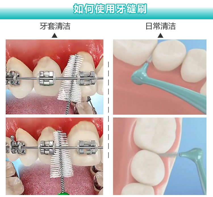 包邮 日本正品dentalpro牙师傅牙缝刷齿间刷 l型10支装 牙齿矫正
