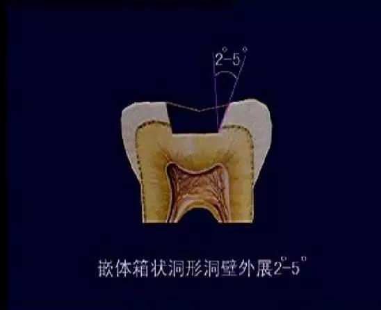 2.预备具有固定形和抗力形的洞型.
